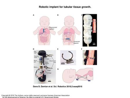 Robotic implant for tubular tissue growth.