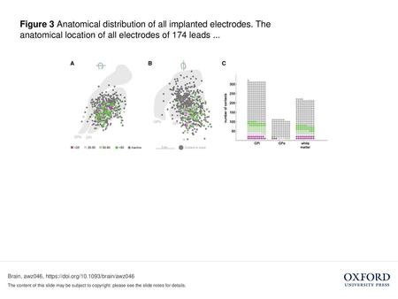 Figure 3 Anatomical distribution of all implanted electrodes