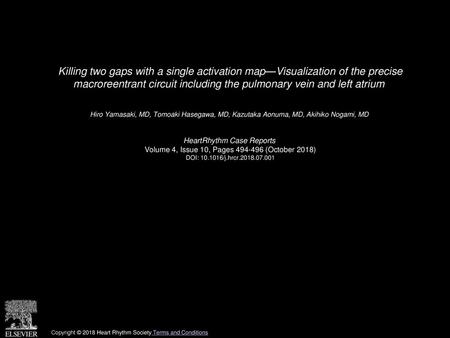 Killing two gaps with a single activation map—Visualization of the precise macroreentrant circuit including the pulmonary vein and left atrium  Hiro Yamasaki,