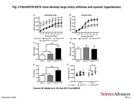 Fig. 3 Fbln4E57K/E57K mice develop large artery stiffness and systolic hypertension. Fbln4E57K/E57K mice develop large artery stiffness and systolic hypertension.