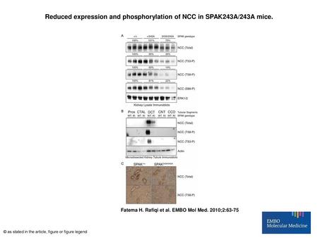 Reduced expression and phosphorylation of NCC in SPAK243A/243A mice.