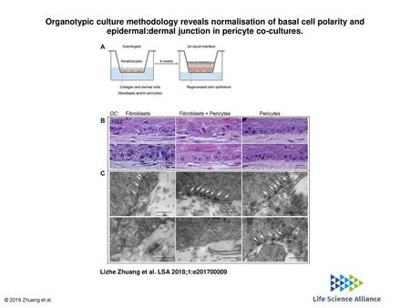 Organotypic culture methodology reveals normalisation of basal cell polarity and epidermal:dermal junction in pericyte co-cultures. Organotypic culture.