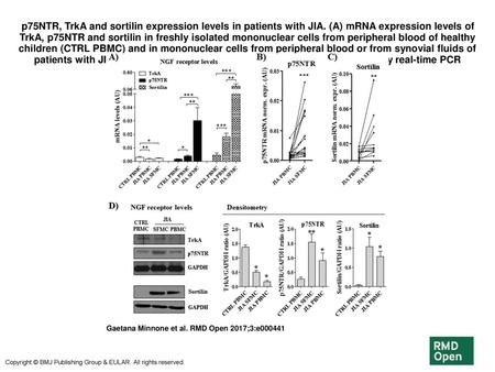 p75NTR, TrkA and sortilin expression levels in patients with JIA