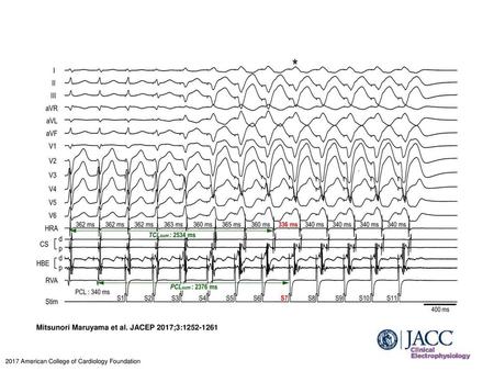 Mitsunori Maruyama et al. JACEP 2017;3: