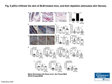 Fig. 6 pDCs infiltrate the skin of BLM-treated mice, and their depletion attenuates skin fibrosis. pDCs infiltrate the skin of BLM-treated mice, and their.