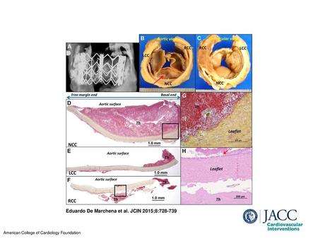 Eduardo De Marchena et al. JCIN 2015;8: