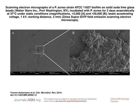 Scanning electron micrographs of a P