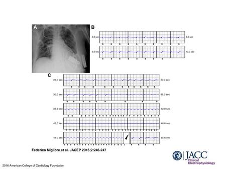 Federico Migliore et al. JACEP 2016;2: