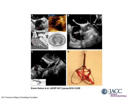 Erwan Salaun et al. JACEP 2017;j.jacep