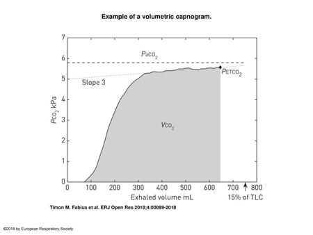 Example of a volumetric capnogram.