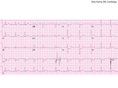 Elias Hanna, MD, Cardiology