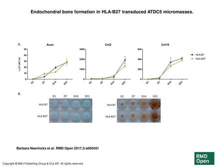 Endochondral bone formation in HLA-B27 transduced ATDC5 micromasses.