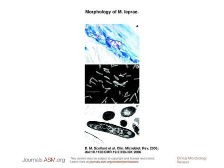 Morphology of M. leprae. Morphology of M. leprae. A. M. leprae is weakly acid fast but, when stained with the Fite-Faraco method, it appears as red, rod-shaped.