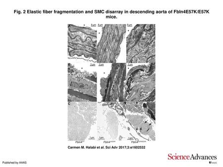 Fig. 2 Elastic fiber fragmentation and SMC disarray in descending aorta of Fbln4E57K/E57K mice. Elastic fiber fragmentation and SMC disarray in descending.