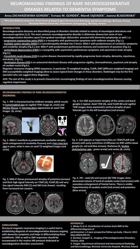 NEUROIMAGING FINDINGS OF RARE NEURODEGENERATIVE DISEASES RELATED TO DEMENTIA SYMPTOMS INTRODUCTION: Neurodegenerative diseases are diversified group of.