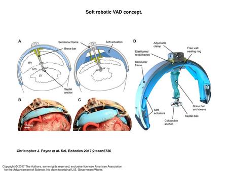 Soft robotic VAD concept.