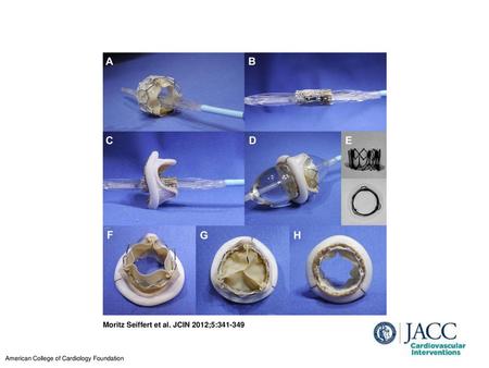 Moritz Seiffert et al. JCIN 2012;5: