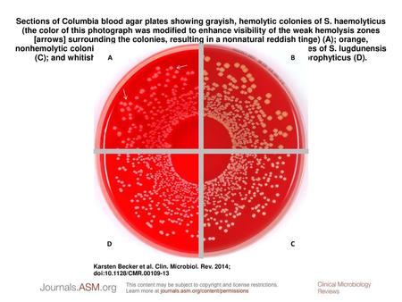 Sections of Columbia blood agar plates showing grayish, hemolytic colonies of S. haemolyticus (the color of this photograph was modified to enhance visibility.