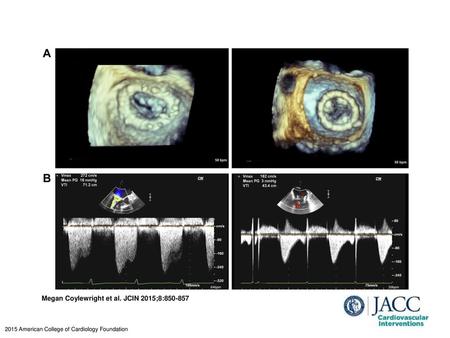 Megan Coylewright et al. JCIN 2015;8: