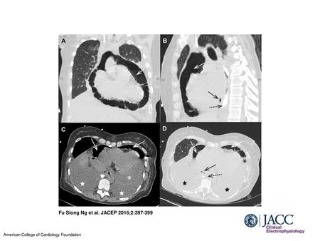 Fu Siong Ng et al. JACEP 2016;2: