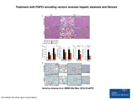 Treatment with FGF21‐encoding vectors reverses hepatic steatosis and fibrosis Treatment with FGF21‐encoding vectors reverses hepatic steatosis and fibrosis.