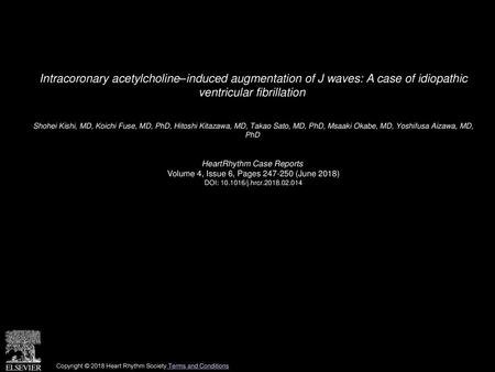 Intracoronary acetylcholine–induced augmentation of J waves: A case of idiopathic ventricular fibrillation  Shohei Kishi, MD, Koichi Fuse, MD, PhD, Hitoshi.