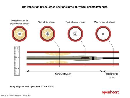 The impact of device cross-sectional area on vessel haemodynamics.