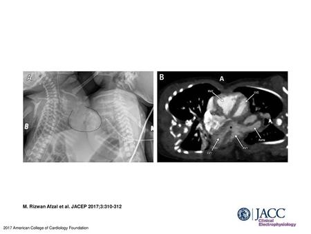 M. Rizwan Afzal et al. JACEP 2017;3: