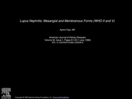 Lupus Nephritis: Mesangial and Membranous Forms (WHO II and V)