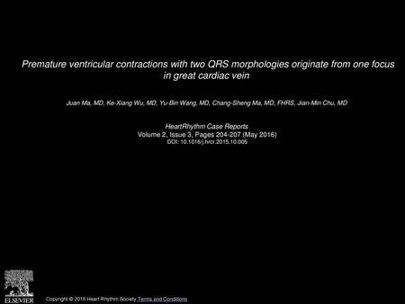 Premature ventricular contractions with two QRS morphologies originate from one focus in great cardiac vein  Juan Ma, MD, Ke-Xiang Wu, MD, Yu-Bin Wang,