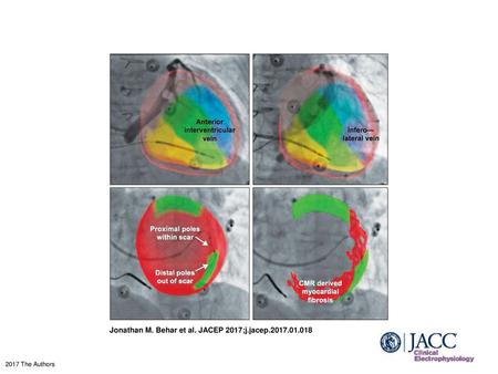 Jonathan M. Behar et al. JACEP 2017;j.jacep