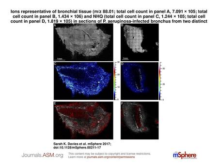 Ions representative of bronchial tissue (m/z 88