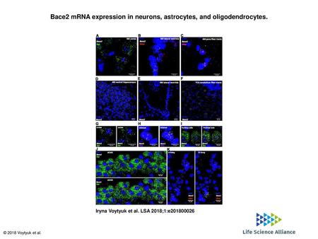 Bace2 mRNA expression in neurons, astrocytes, and oligodendrocytes.