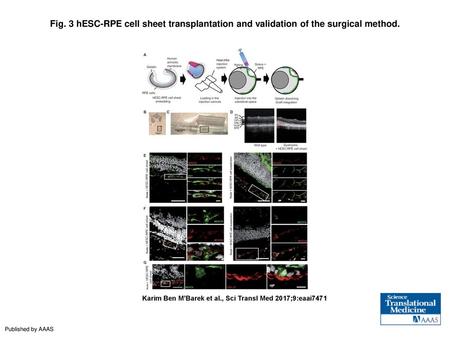 Fig. 3 hESC-RPE cell sheet transplantation and validation of the surgical method. hESC-RPE cell sheet transplantation and validation of the surgical method.