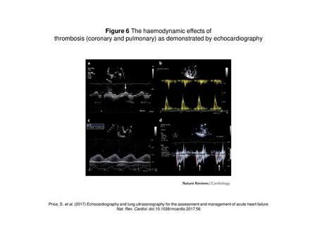 Figure 6 The haemodynamic effects of