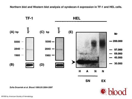 Northern blot and Western blot analysis of syndecan-4 expression in TF-1 and HEL cells. Northern blot and Western blot analysis of syndecan-4 expression.