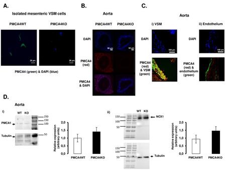 (red) & endothelium (green) PMCA4 (green) & DAPI (blue)