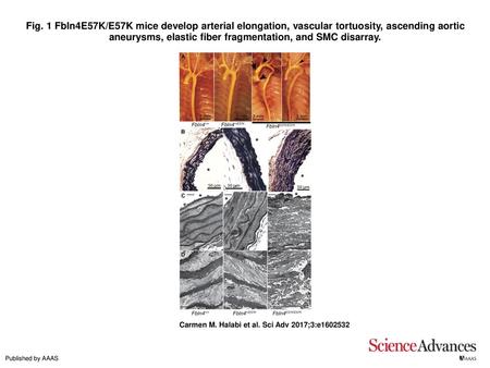 Fig. 1 Fbln4E57K/E57K mice develop arterial elongation, vascular tortuosity, ascending aortic aneurysms, elastic fiber fragmentation, and SMC disarray.