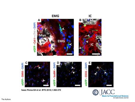 Isaac Perea-Gil et al. BTS 2016;1: