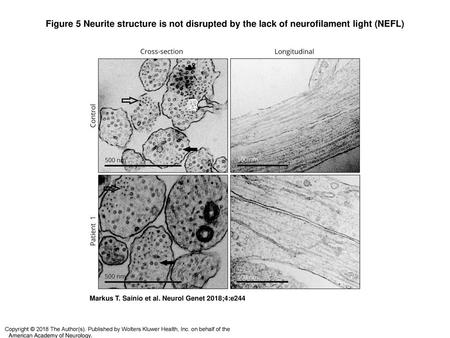 Figure 5 Neurite structure is not disrupted by the lack of neurofilament light (NEFL)‏ Neurite structure is not disrupted by the lack of neurofilament.