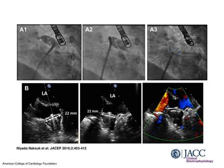 Niyada Naksuk et al. JACEP 2016;2: