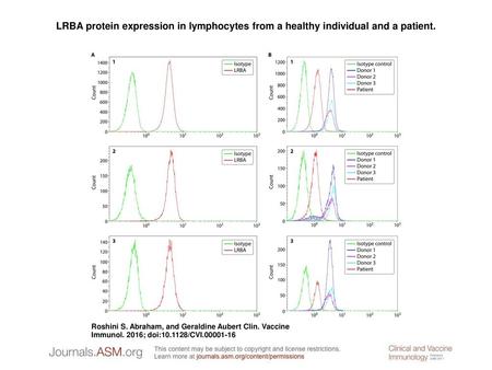 LRBA protein expression in lymphocytes from a healthy individual and a patient. LRBA protein expression in lymphocytes from a healthy individual and a.