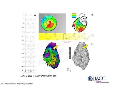 John L. Sapp et al. JACEP 2017;3: