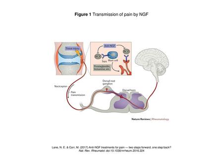 Figure 1 Transmission of pain by NGF