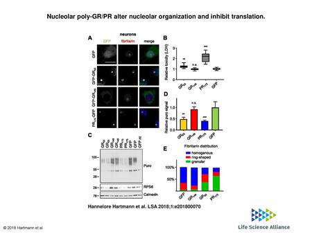 Nucleolar poly-GR/PR alter nucleolar organization and inhibit translation. Nucleolar poly-GR/PR alter nucleolar organization and inhibit translation. GFP,