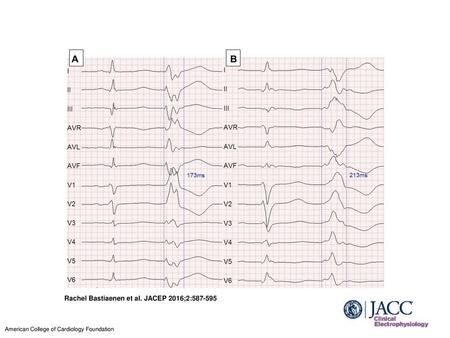 Rachel Bastiaenen et al. JACEP 2016;2: