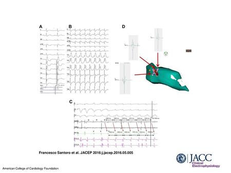 Francesco Santoro et al. JACEP 2016;j.jacep