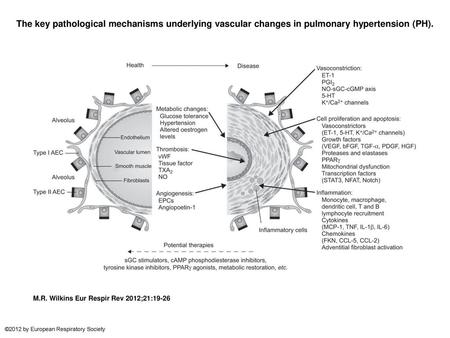 The key pathological mechanisms underlying vascular changes in pulmonary hypertension (PH). The key pathological mechanisms underlying vascular changes.