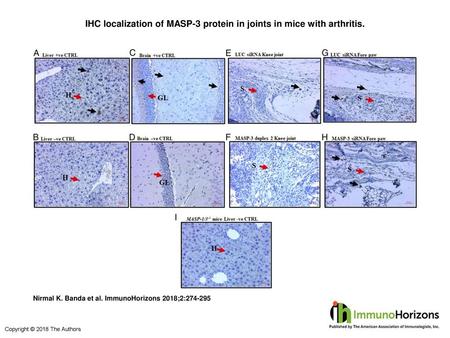 IHC localization of MASP-3 protein in joints in mice with arthritis.