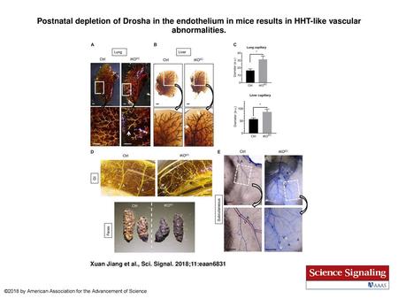 Postnatal depletion of Drosha in the endothelium in mice results in HHT-like vascular abnormalities. Postnatal depletion of Drosha in the endothelium in.